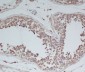 Anti-BDNF Rabbit Monoclonal Antibody